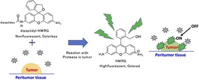 Advancement of fluorescent aminopeptidase probes for rapid cancer detection–current uses and neurosurgical applications